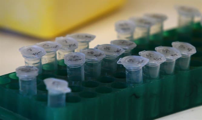 Nouvelle percée israélienne dans la lutte contre le Corona